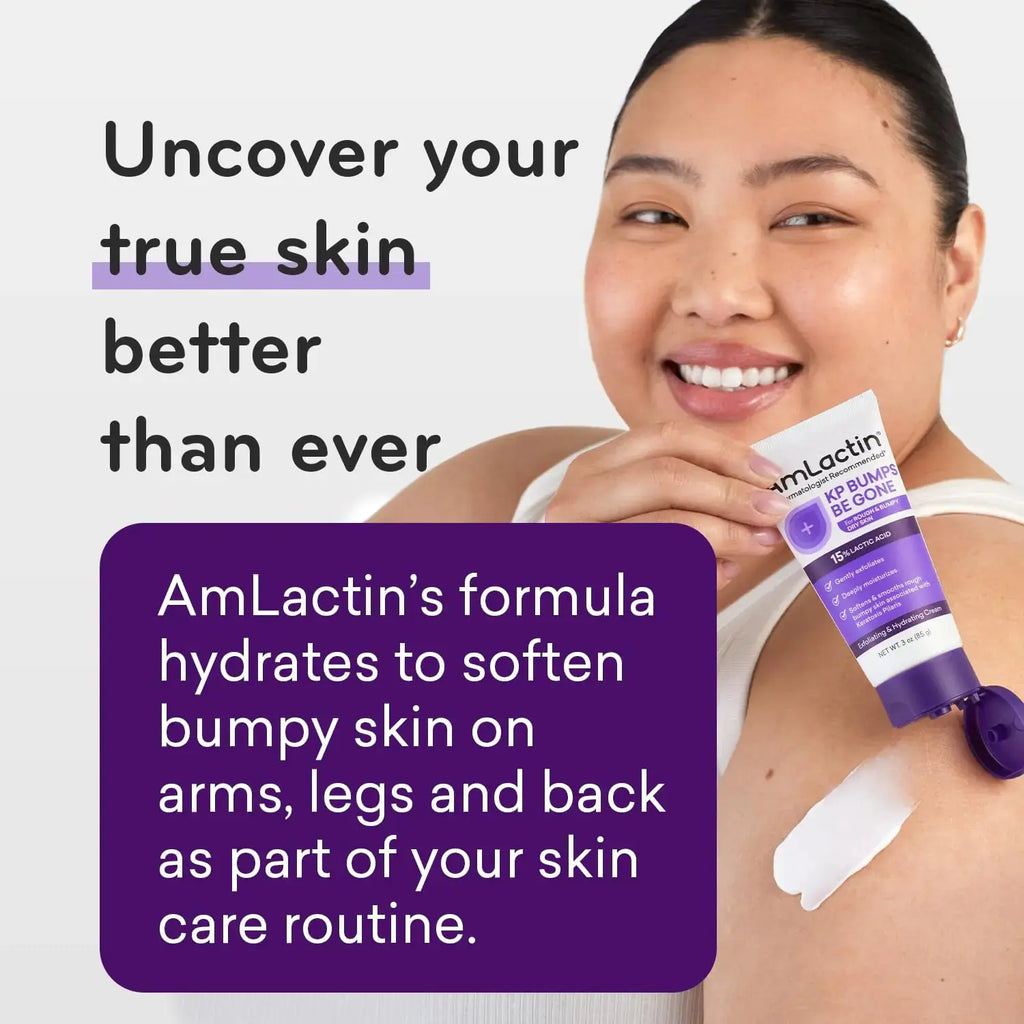AmLactin KP Bumps Be Gone Moisturizing Cream - Made For Rough and Bumpy Skin