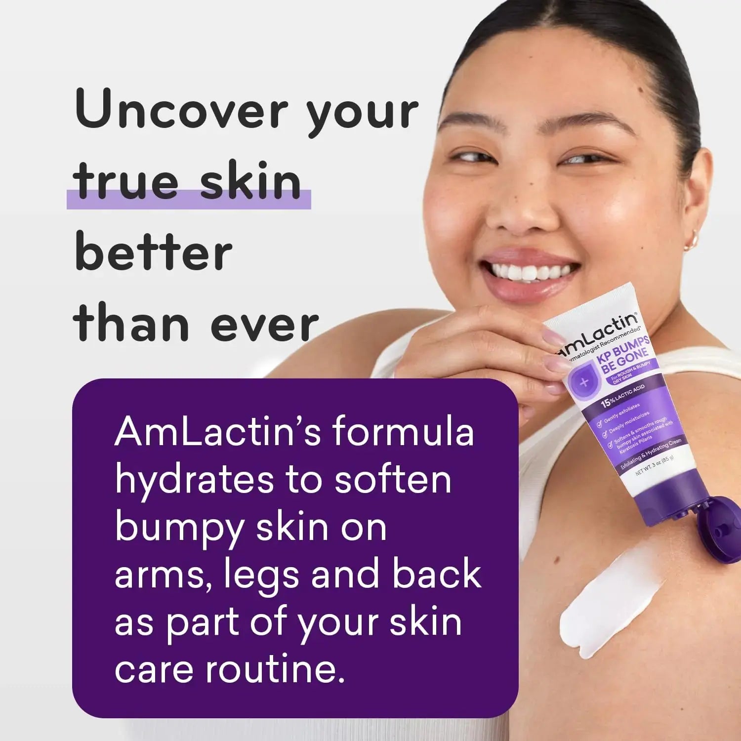 AmLactin KP Bumps Be Gone Moisturizing Cream - Made For Rough and Bumpy Skin