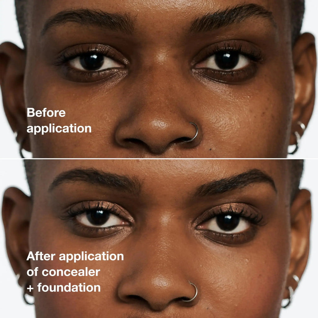 Clinique Even Better All-Over Full Coverage Concealer + Eraser For Dark Circles