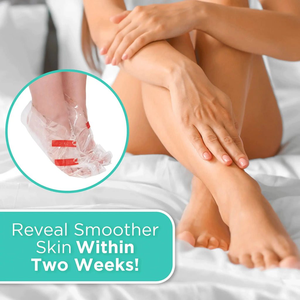 DERMORA Foot Peel Mask – 2 Pack French Lavender Exfoliating Foot Masks for Soft, Smooth Feet