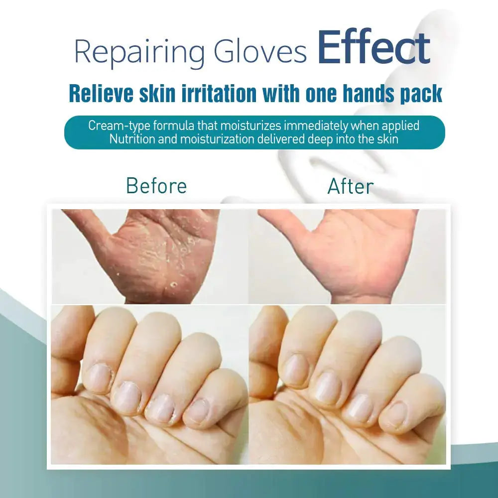 Epielle Intensive Repairing Hand Masks - 6 Pack | Deep Moisture Gloves for Dry, Cracked Hands