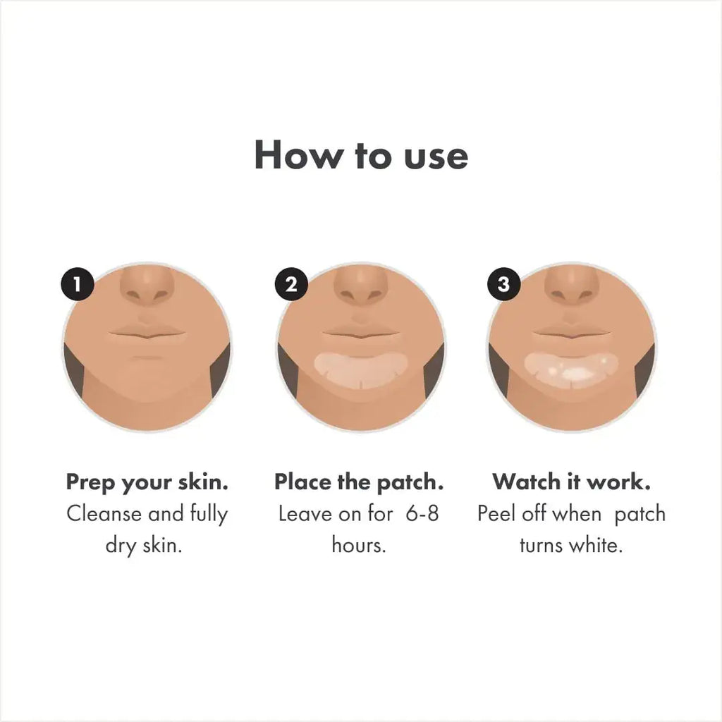 Hero Cosmetics Mighty Patch™ | XL Contoured Hydrocolloid Chin Pimple Patch