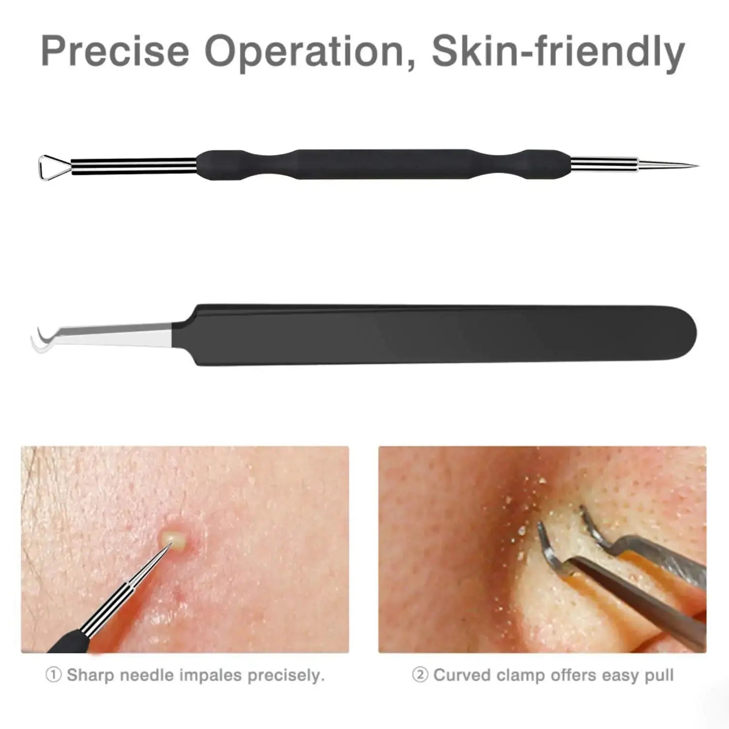 JPNK Blackhead Remover Tool Kit – 6 Pcs Acne & Zit Removal Kit with Leather Bag (Black)