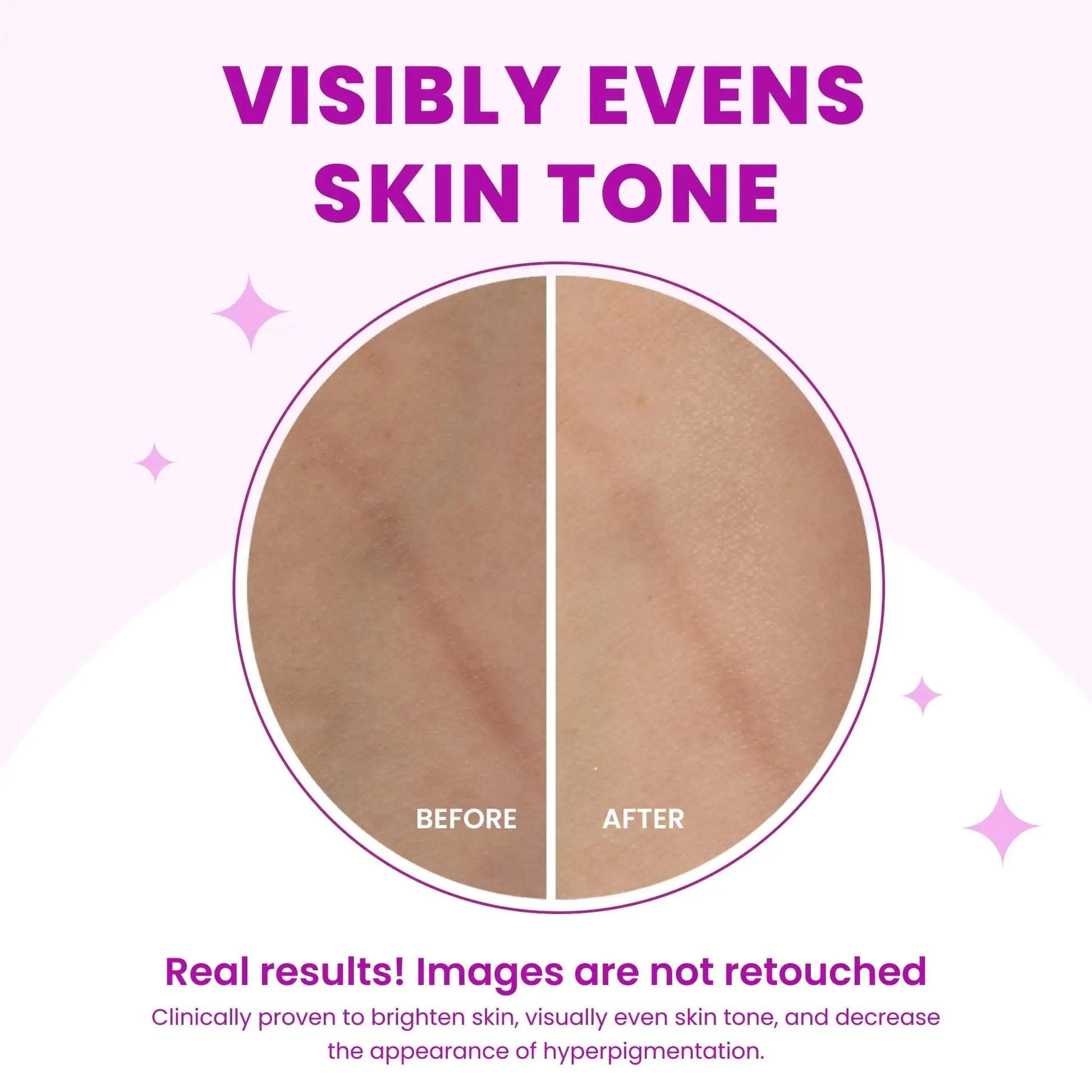Lume Acidified Body Cleansing Bar - Formulated Without SLS orParabens
