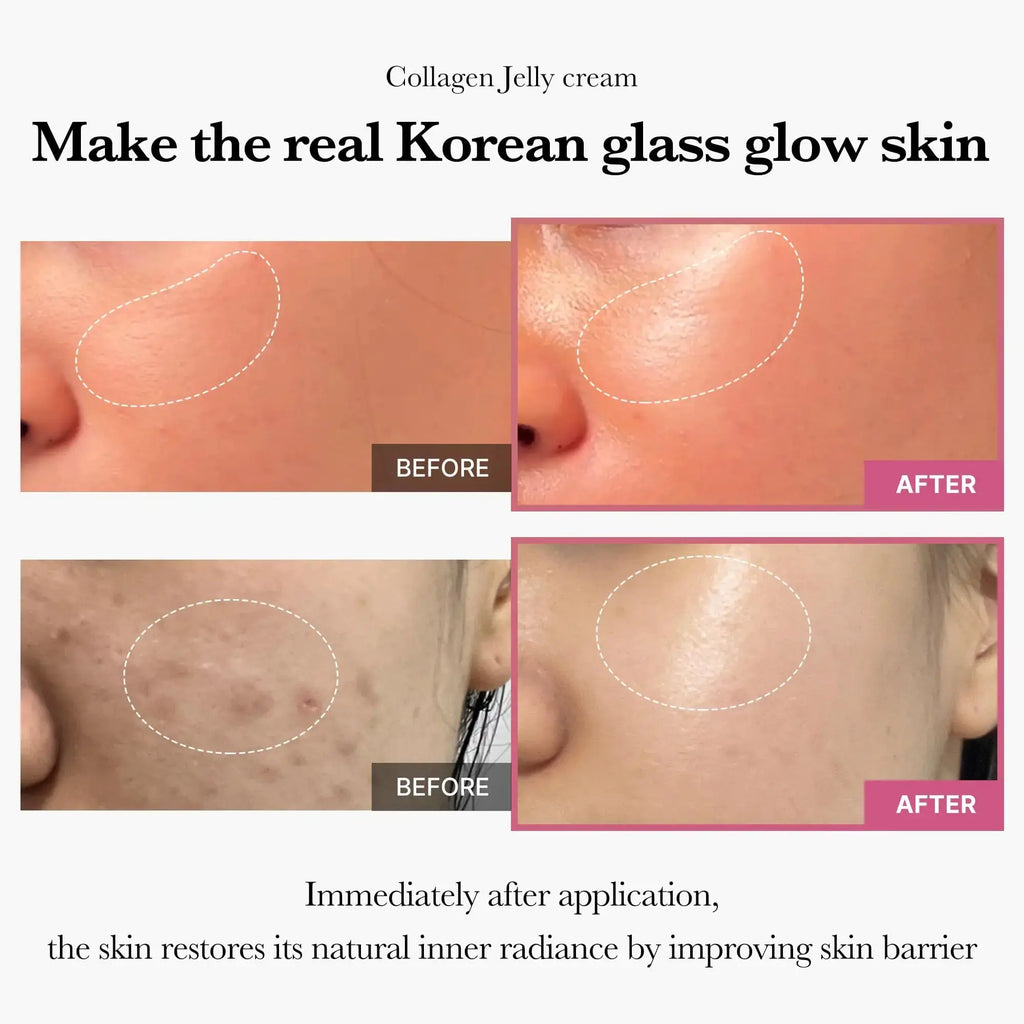 Medicube Collagen Jelly Cream - Niacinamide & Freeze-Dried Hydrolyzed Collagen | 24h Glow & Lifted Look