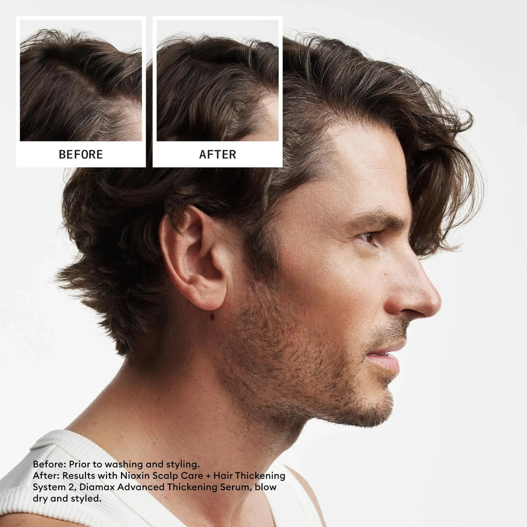 Nioxin System 2 Scalp Cleansing Shampoo with Peppermint Oil – For Dry & Sensitive Natural Hair