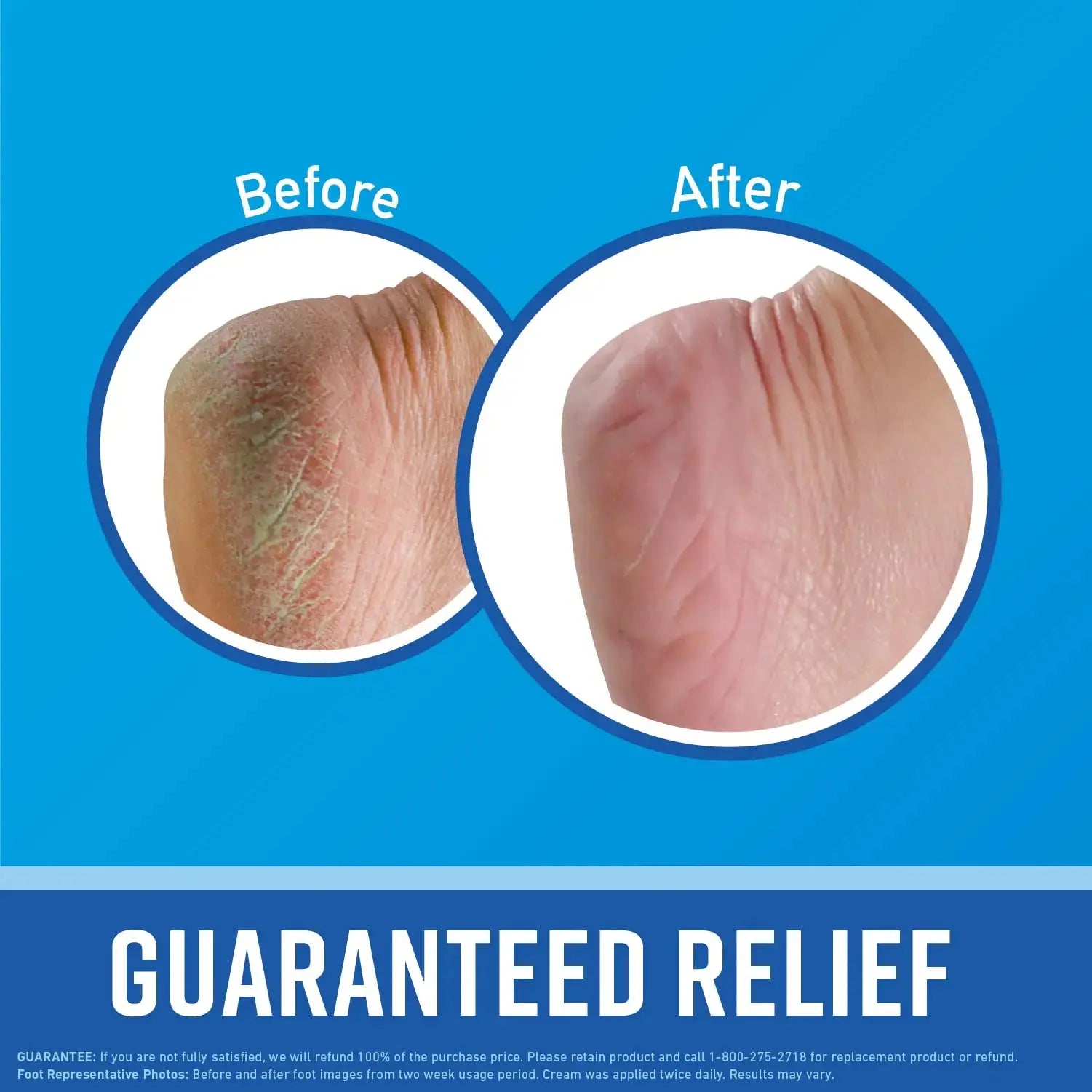 O'Keeffe's for Healthy Feet Foot Cream - Guaranteed Relief for Extremely Dry & Cracked Feet