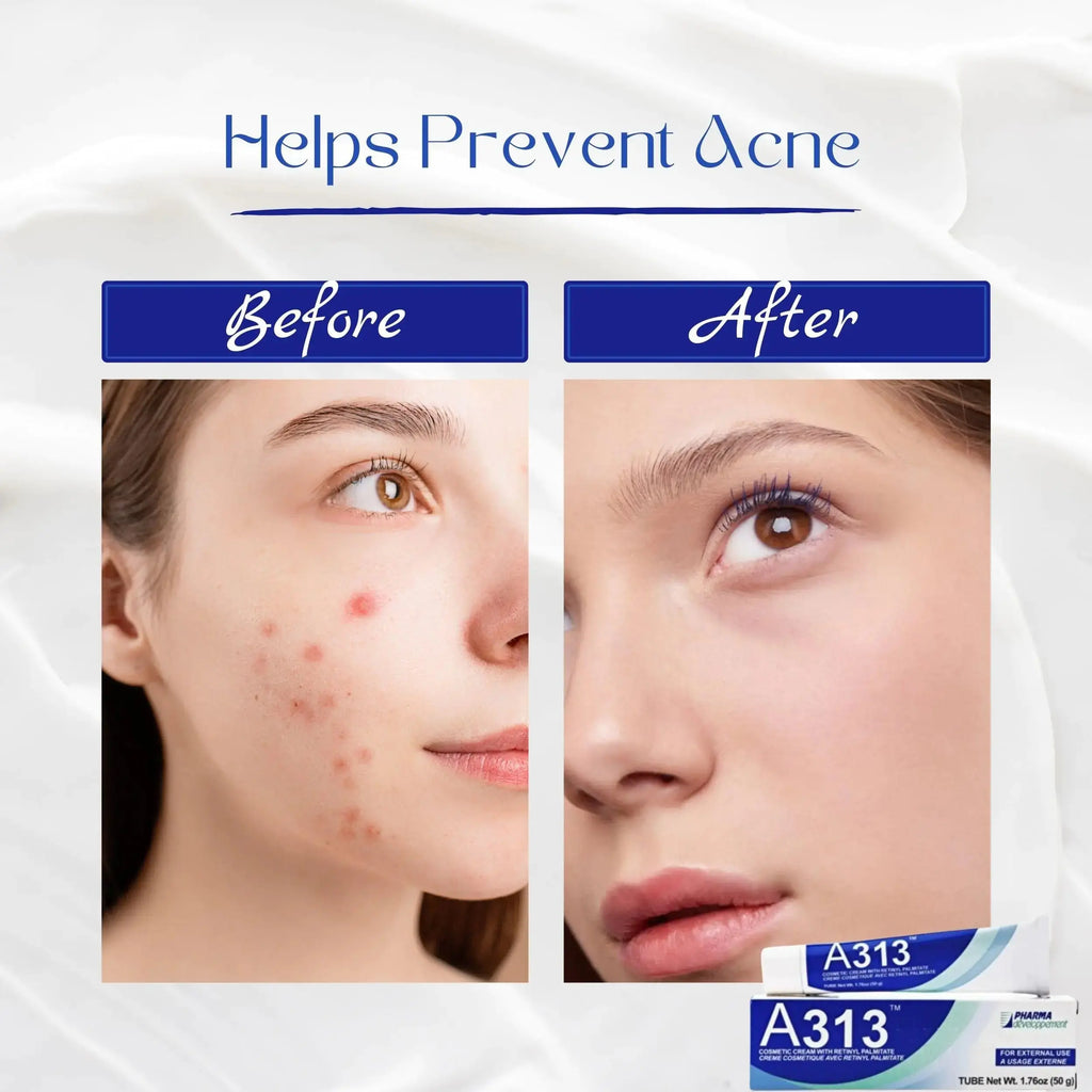Pharma Development A313 Retinol Pommade Anti Aging Night Cream - The pore cleansing skin cream