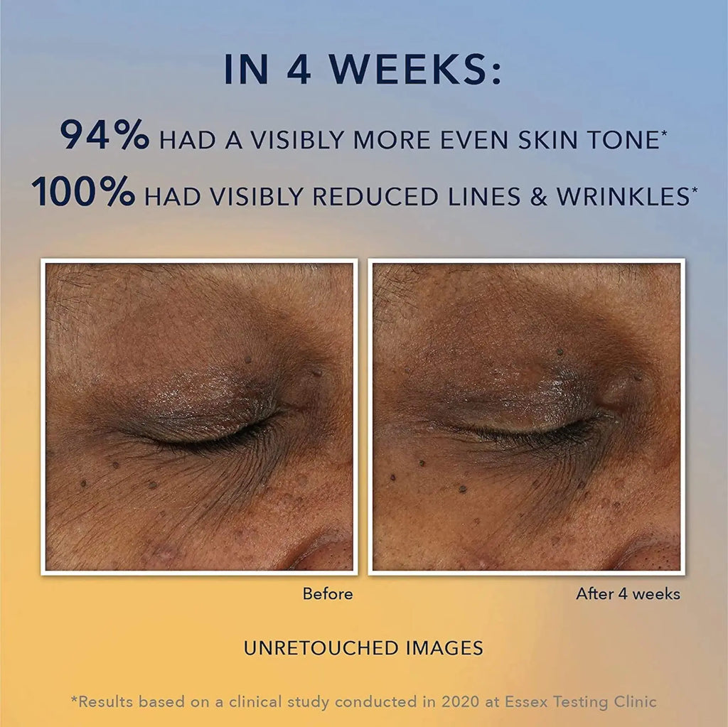 RoC Multi Correxion Revive + Glow 10% Active Vitamin C Serum – Anti-Aging & Brightening Treatment