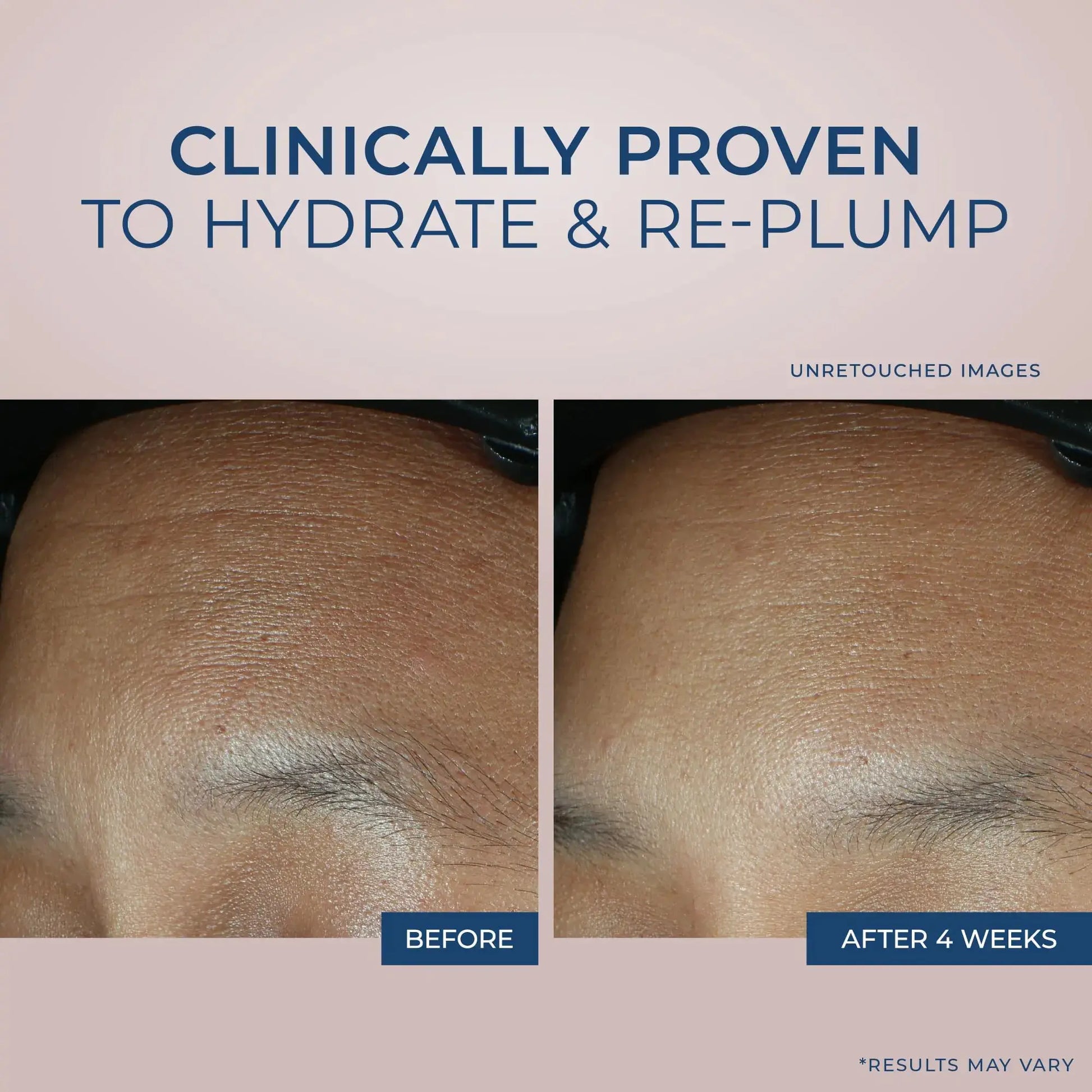 RoC Retinol Correxion Max Daily Hydration Anti-Aging Face Moisturizer with Hyaluronic Acid