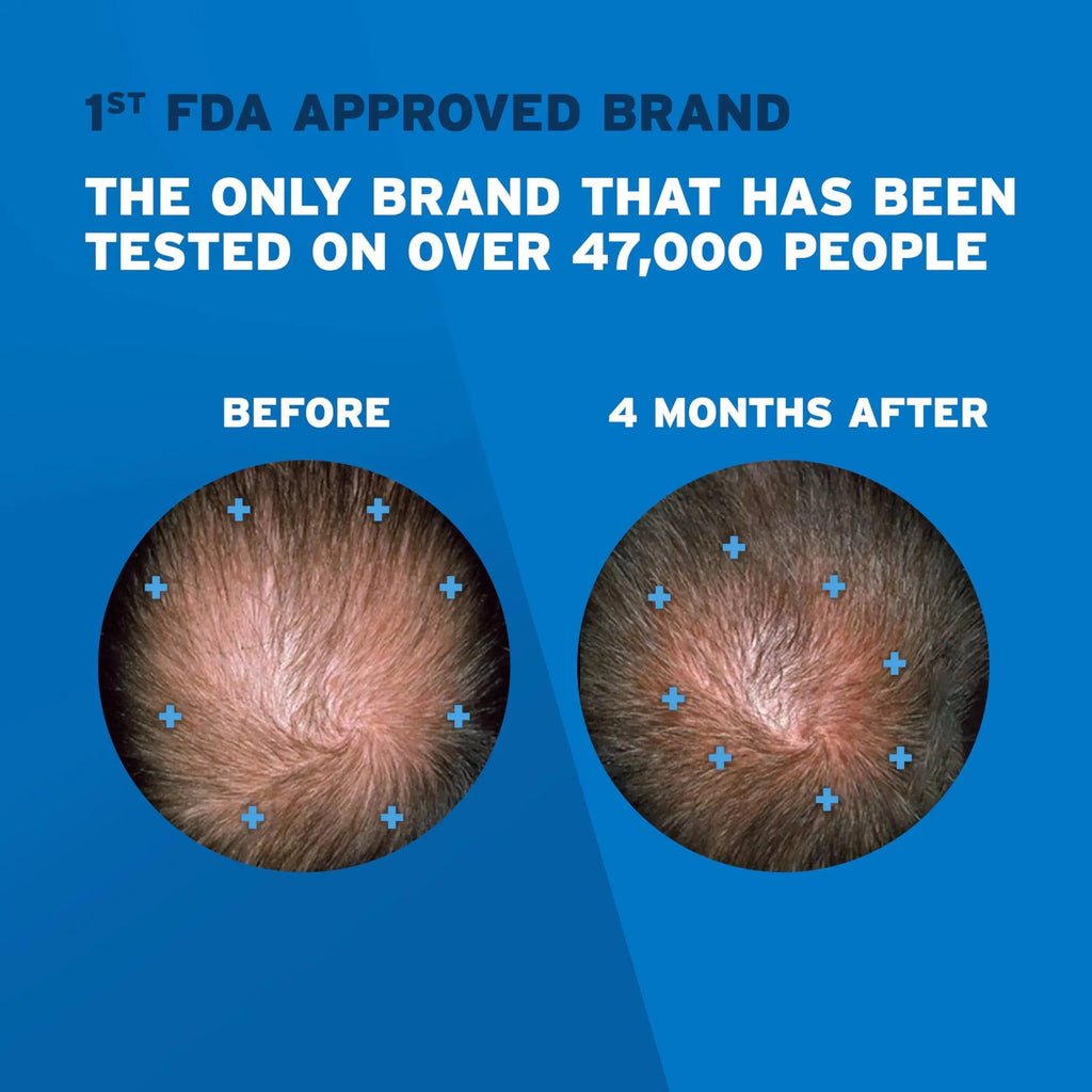 Rogaine Extra Strength Minoxidil Solution