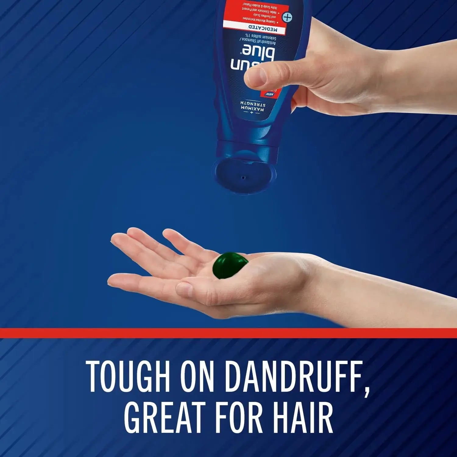 Selsun Blue Medicated Anti-dandruff Shampoo with Menthol, 11 fl. oz., Maximum Strength, Selenium Sulfide 1% 11 Fl Oz (Pack of 1)