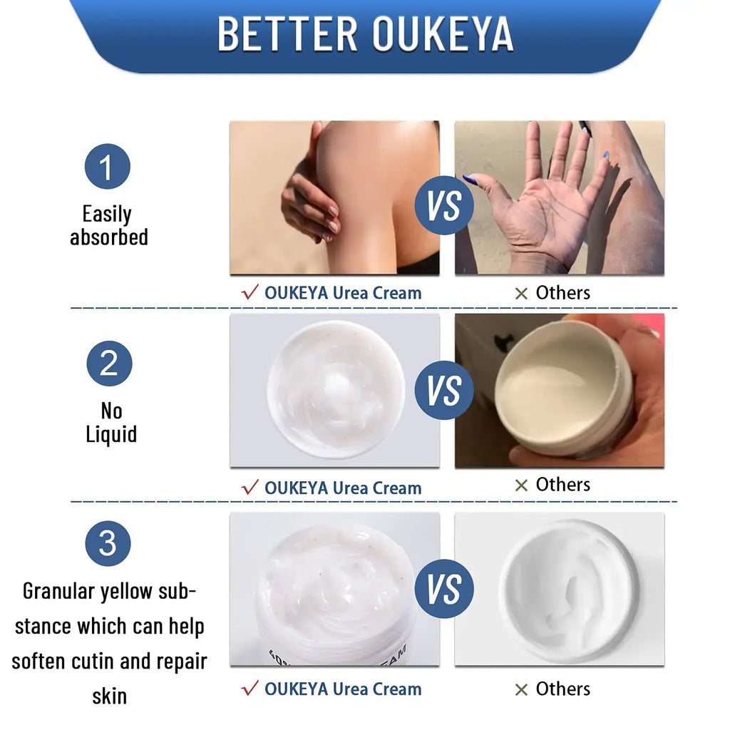 Urea Cream 40 Percent, Urea Foot & Hand Cream for Dry Cracked, 40 per Urea Lotion for Feet Maximum Strength (4 Packs) 5.29 Ounce (Pack of 4)