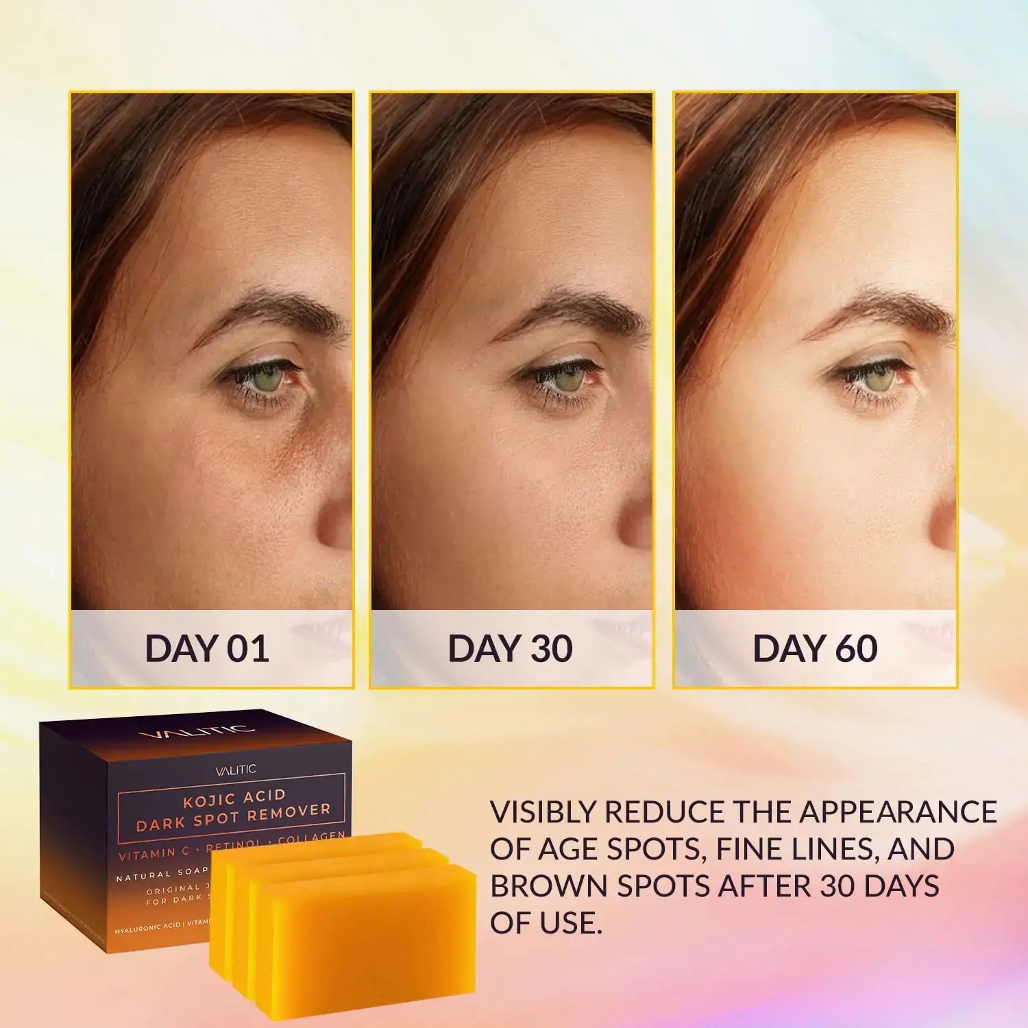 Valitic Unisex Kojic Acid Dark Spot Remover Bar with Vitamin C, Retinol, Collagen