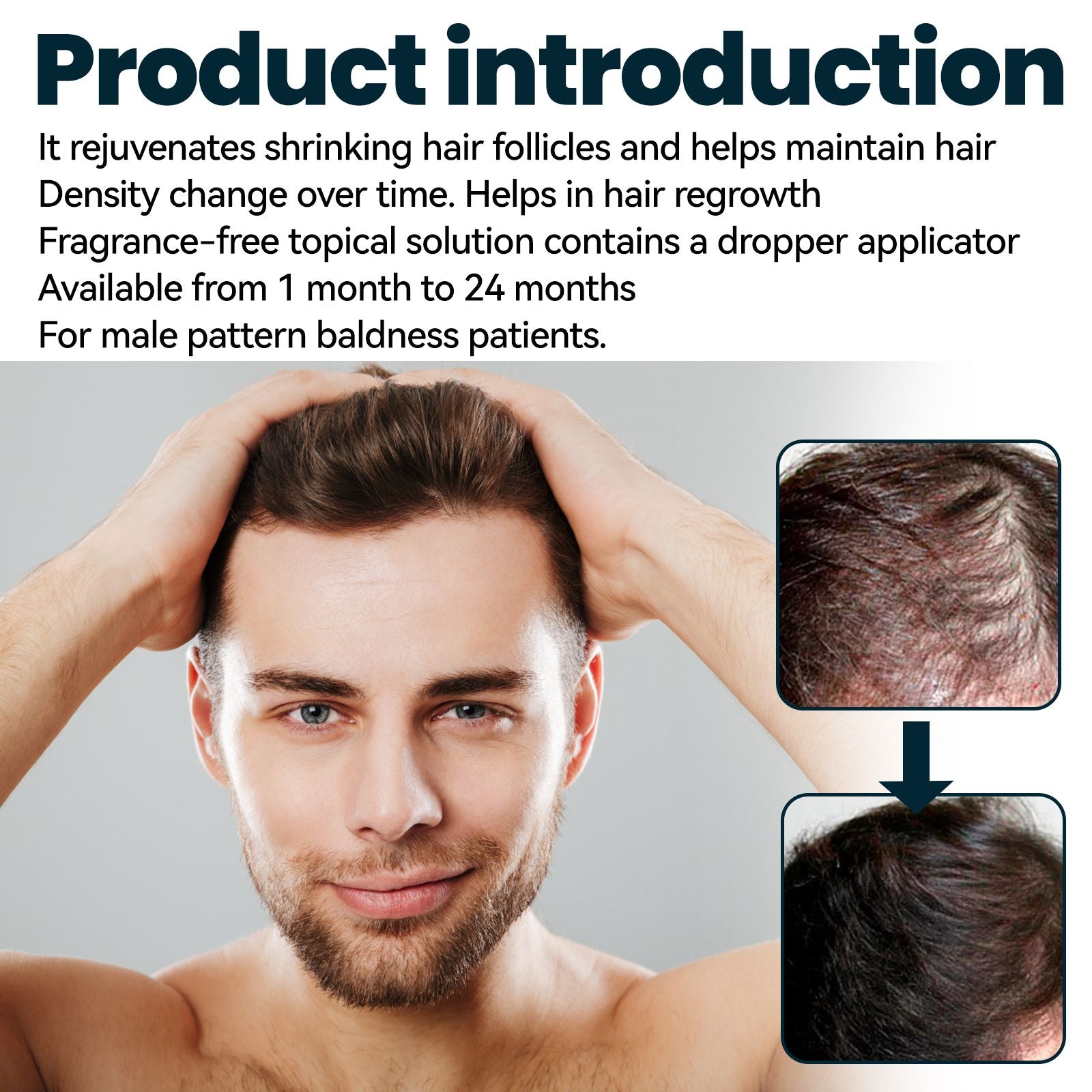East Moon Hair Conditioner For Men, Men's Hair Nutrition Care Anti-Set Hair Thickening Serum
