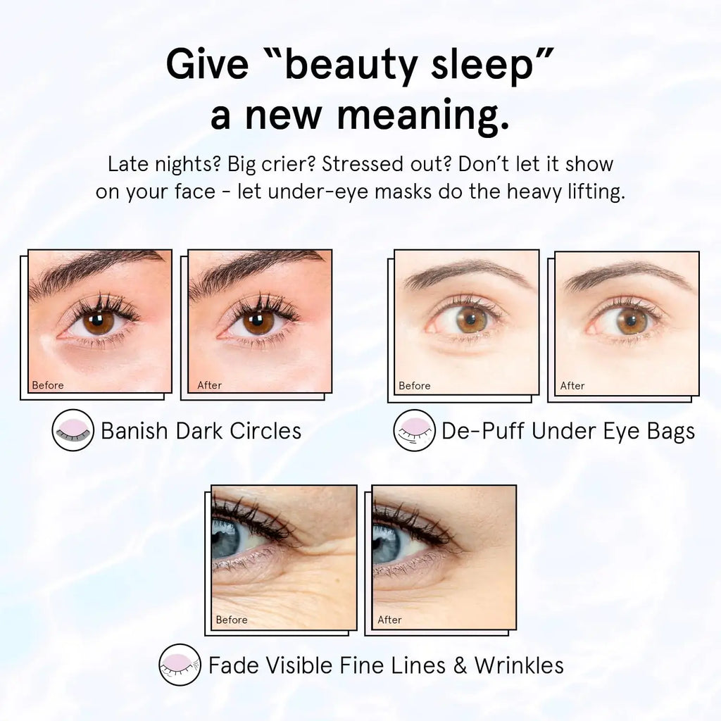 grace & stella Restoring Purple Eye Masks - Dermatologist Tested Eye Treatment Gels Cruelty-Free