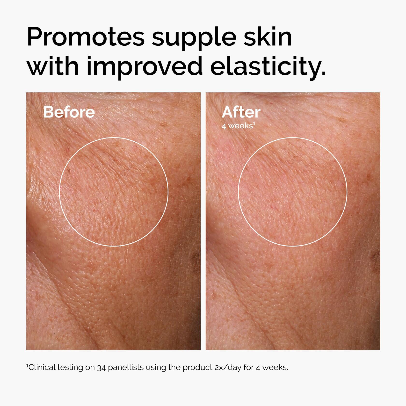 The Ordinary Hyaluronic Acid 2% + B5 Serum Hydrating Moisturizer 1oz