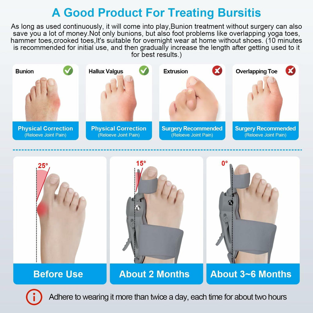 Grzcp Bunion Corrector for Women & Men – Adjustable Toe Splint, Relief