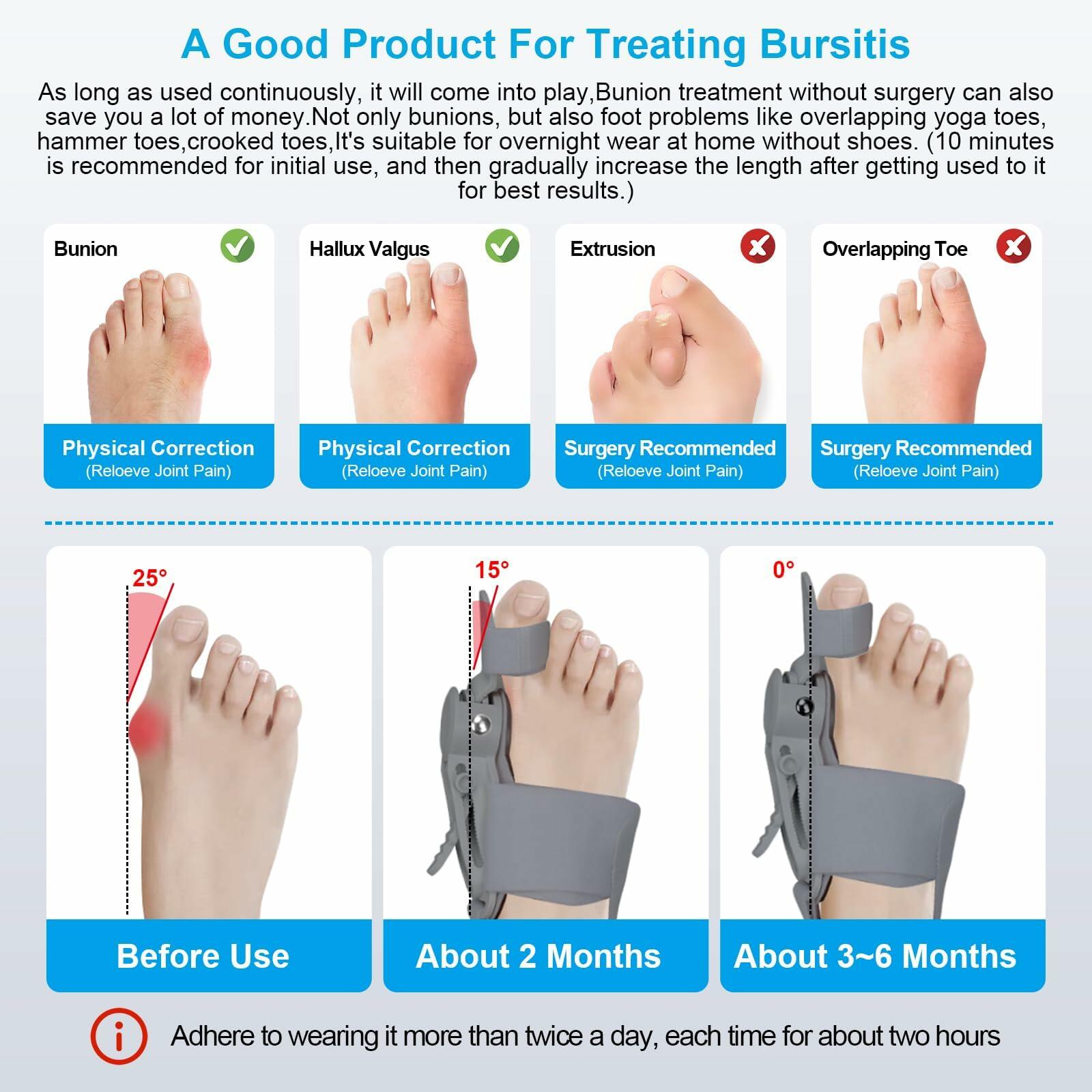 Grzcp Bunion Corrector for Women & Men – Adjustable Toe Splint, Relief